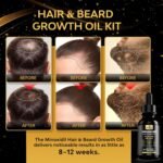 Minoxidil Beard Growth Kit For Men and Women, Hair Loss and Hair Regrowth